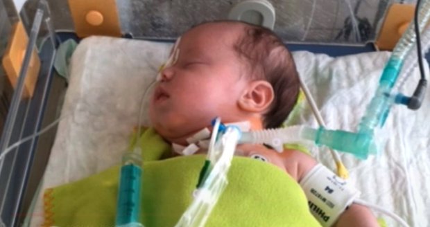 9 hodin na sále: Lékaři z Motola odstraňovali nádor tříměsíčnímu chlapečkovi