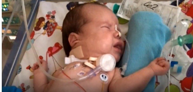 Dvouměsíční Mário nemůže dýchat kvůli nádoru! Zachránit ho může jen náročná operace.