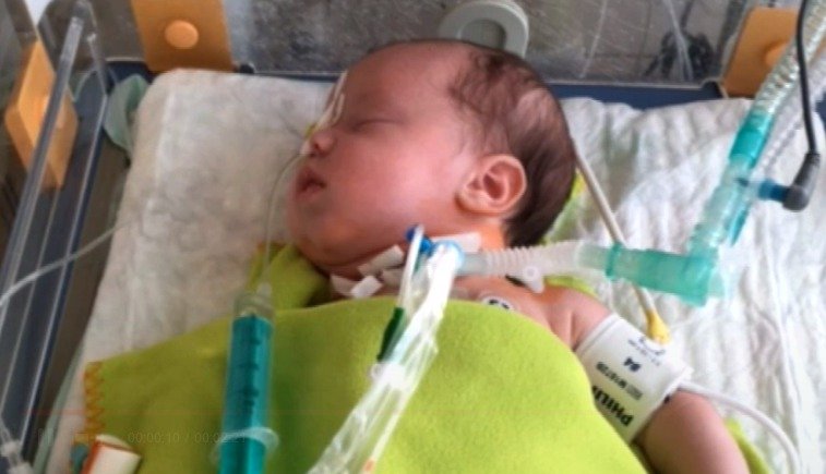 Dvouměsíční Mário nemůže dýchat kvůli nádoru! Zachránit ho může jen náročná operace