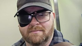 Mark Bryan podstupující operaci oka