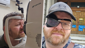 Mark Bryan podstupující operaci oka