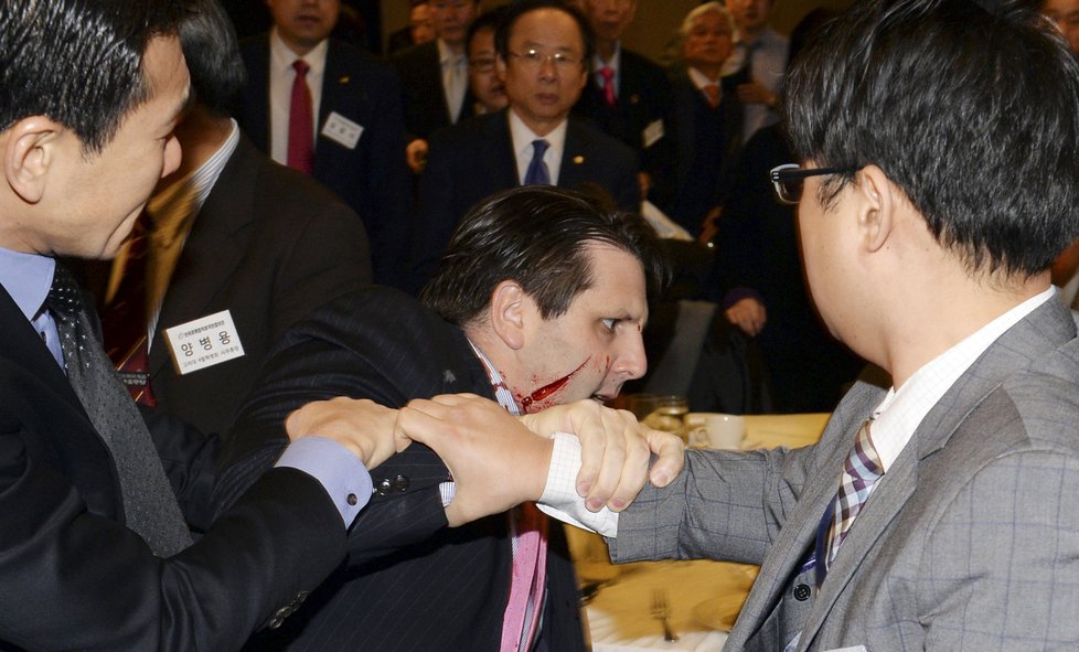 Útočník děsivě zranil amerického velvyslance v Jižní Koreji