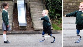 Dojemné obrázky: Chlapec bez končetin září štěstím: Jsem jako akční hrdina