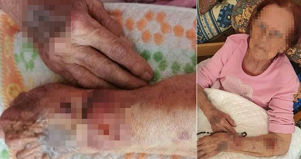 Babičku Martu (85) pustili z nemocnice s otevřenými ranami: Lékař místo omluvy šokoval