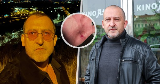 Hofmann se zranil při natáčení