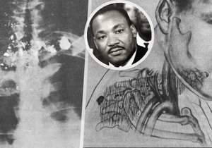 Martina Luthera Kinga zabil jedinou ranou režisér pornofilmů!