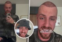 Prágr po finále Survivoru přiznal: Podstoupil transplantaci