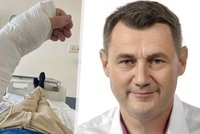 Vážný úraz hejtmana Půty: Křísili ho na ulici! Zlomil si ruku a čeká ho operace