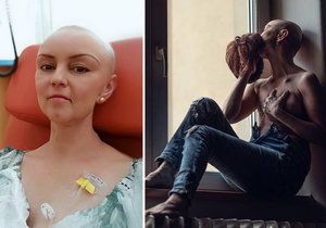 Fotky, ze kterých mrazí! Trojnásobná máma ukázala svůj boj s rakovinou a poslala jasný vzkaz