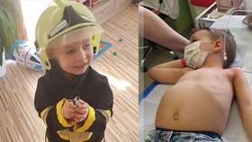 Matěj (4) trpí těžkou formou hemofilie: Vnitřní krvácení může způsobit sebemenší náraz