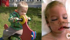 Matěj (9) je po trhání mandlí už 6 let v kómatu: Nemocnice má vyplatit 10,5 milionu