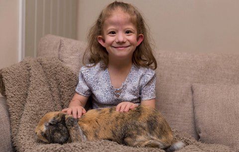 Matilda trpí vzácným syndromem, který má pouze dvacet lidí na celém světě