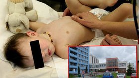 Jihlavská nemocnice tvrdí, že chlapeček mohl virus chytit na narozeninové oslavě.