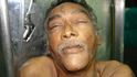 Podivná úmrtí pacientů v psychiatrické klinice Mazorra v Havaně