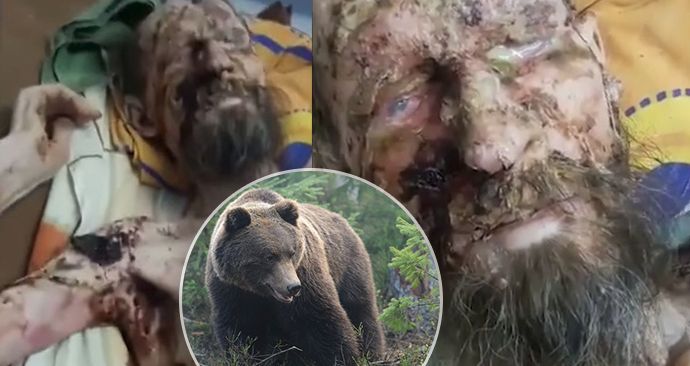 Tajemství „medvědího muže“ odhaleno! Kazašský lékař odhalil, o koho doopravdy jde