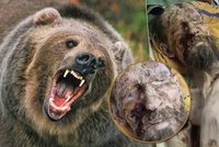 Zvrat v příběhu „oživlé mumie z medvědího brlohu“: Lékaři odhalili prognózu