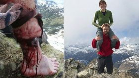 Andiho v rumunských horách napadl medvěd. Turista se štěstím přežil.