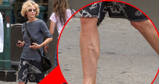Meg Ryan na procházce New Yorkem ukázala své křečové žíly.