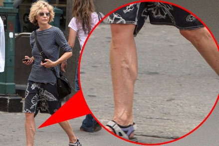 Meg Ryan na procházce New Yorkem ukázala své křečové žíly.