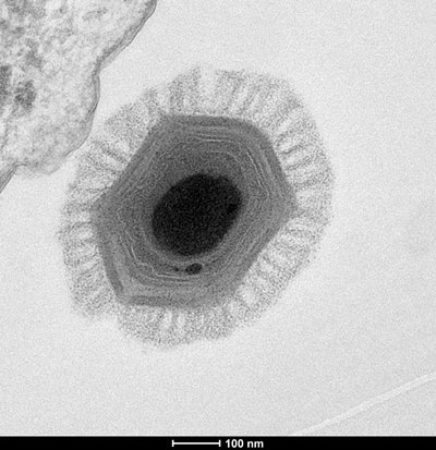 Megavirus byl v roce 2010 objeven u pobřeží Chile