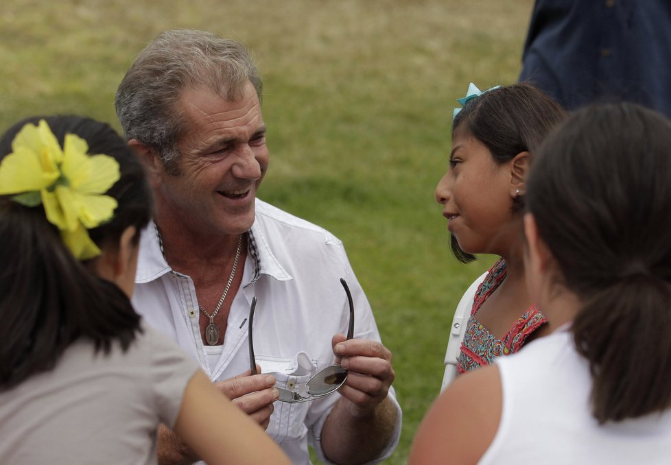 Mel Gibson se v Malibu setkal s oddělenými siamskými dvojčaty