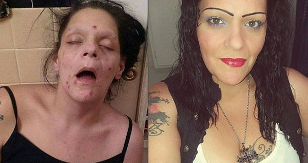 »Vypadala jsem jako mrtvola!« Šokující snímky matky, která porazila závislost na drogách