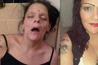 »Vypadala jsem jako mrtvola!« Šokující snímky matky, která porazila závislost na drogách