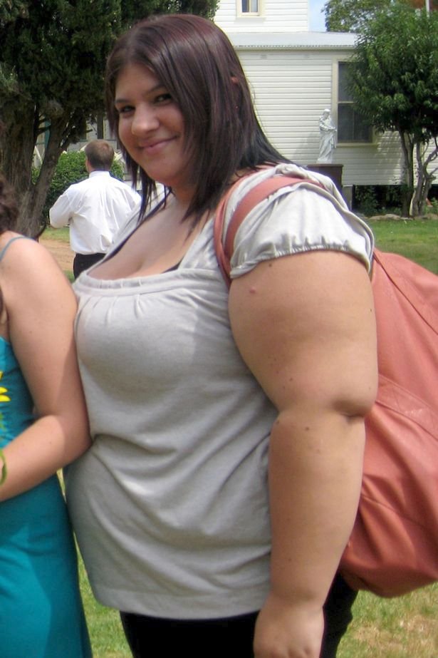 Mladá žena zhubla 65 kilo.