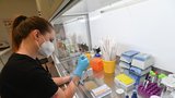 Mendelova univerzita: První vysoká škola u nás testuje metodou PCR ze slin