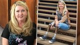 Zákeřná nemoc ji připravila o nohy: Chtěla jsem umřít, přiznala poslankyně Brzobohatá