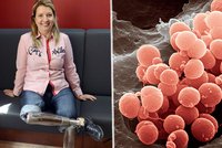 Poslankyně přišla kvůli meningokoku o nohy: Proti zákeřné infekci chce očkovat více dětí