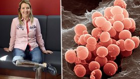 Andrea Brzobohatá (za ANO) před lety onemocněla meningitidou a lékaři jí museli amputovat dolní končetiny.