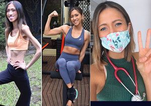 Studentka medicíny bojovala s anorexií: Běhala, dokud jí nekrvácely nohy!