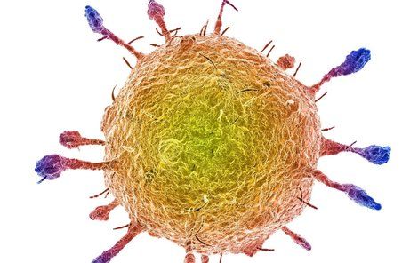 Mers Rady Je smrtelné onemocnění MERS v Česku? | Ahaonline.cz
