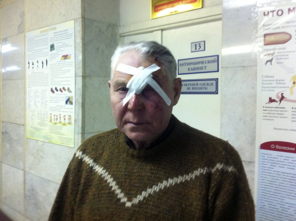 Muž utrpěl při nárazu tlakové vlny zranění obličeje