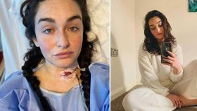 Bloggerka Mia (25) myslela, že je těhotná: Je to rakovina, šokovali ji lékaři