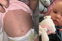 Postcovidový syndrom u miminka na Ostravsku: Mia (7 měs.) skončila na ARO! Lékaři tvrdili, že jí rostou zoubky
