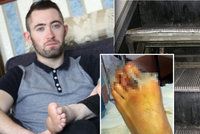 Pozor na eskalátory! Michaelovi (27) amputovaly jezdící schody prsty