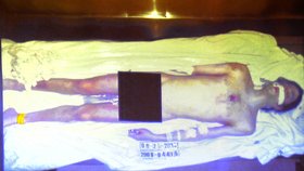 Šokující foto: U soudu v Los Angeles ukázali nahé tělo Michaela Jacksona. Fotka byla pořízena těsně předtím, než bylo odvezeno na pitvu