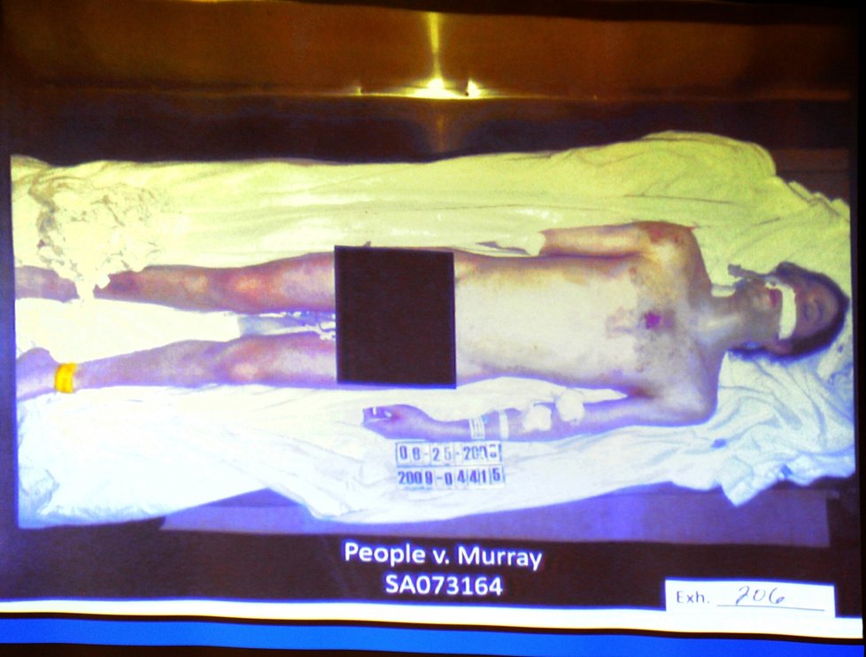 Šokující foto: U soudu v Los Angeles ukázali nahé tělo Michaela Jacksona. Fotka byla pořízena těsně předtím, než bylo odvezeno na pitvu