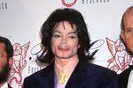 Michael jackson  byl famózní zpěvák na sklonku jeho života se n něm ale promítaly plastické operace a zdravotní problémy