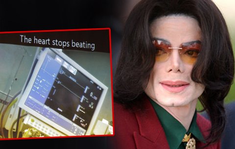 U soudu byla zveřejněna fotografie, na které je vidět zástava srdce Michaela Jacksona