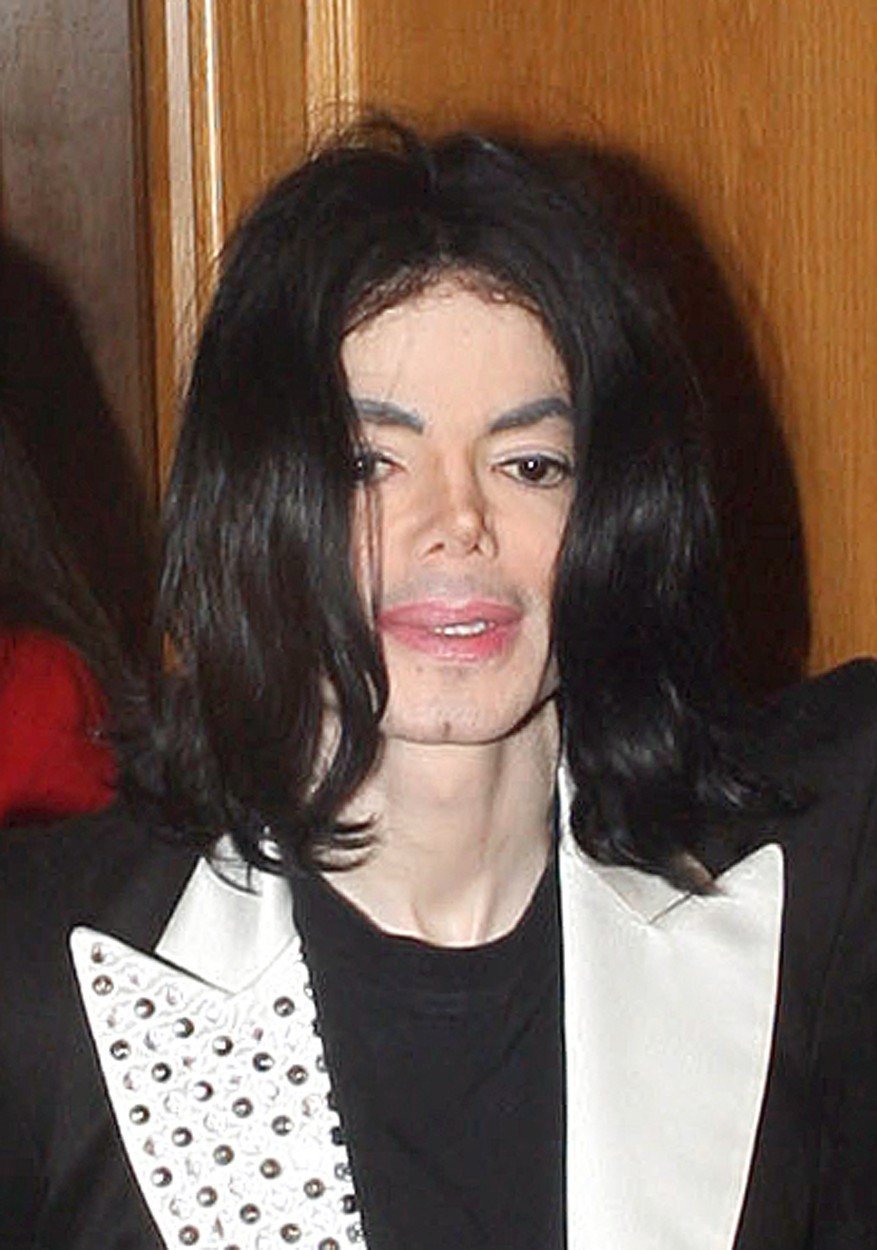 Michael Jackson po všech plastikách budil hrůzu.