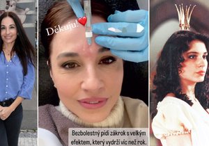 „Jasněnka“ Kuklová si nechává aplikovat kyselinu hyaluronovou