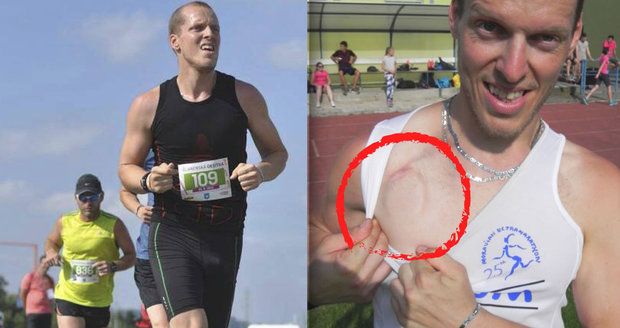 Michalovi se ve spánku zastavilo srdce: S defibrilátorem se teď chystá na ultramaraton