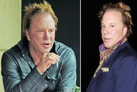 Mickey Rourke: Po zpackaných plastikách má zjizvenou tvář
