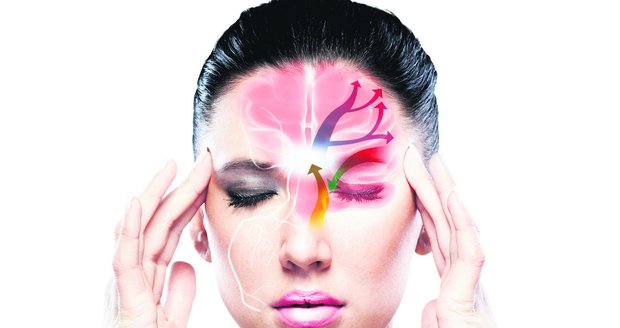 Z nitra hlavy šíří trojklané nervy migrénu dál do hlavy