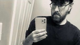 Michael Phillips tvrdí, že ná "nejmenší penis na světě", má diagnostikovaný mikropenis.