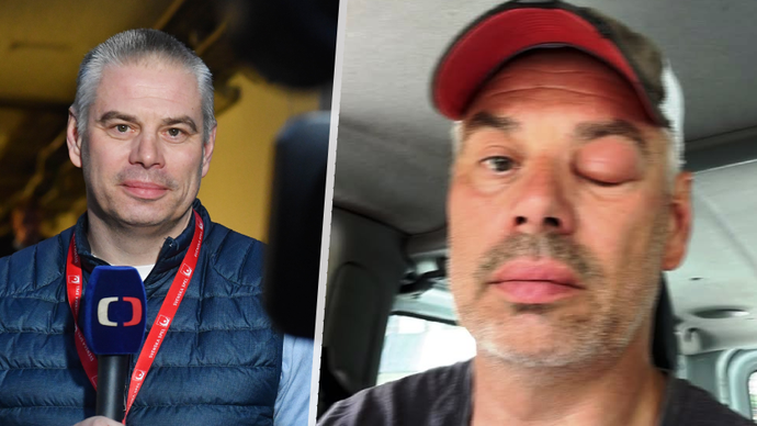 Antoše čeká na ČT turnaj v Brně, takto ale na obrazovku nemůže.
