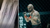 Drsné natáčení Bojovníka: Z placu rovnou na sál! Jackuliak v nemocnici, Ondrík na obstřicích a Vacula se svíjel bolestí